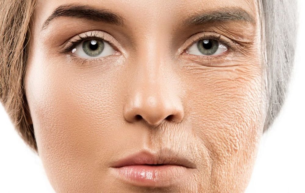 زیادتر دیده شدن سن زنان