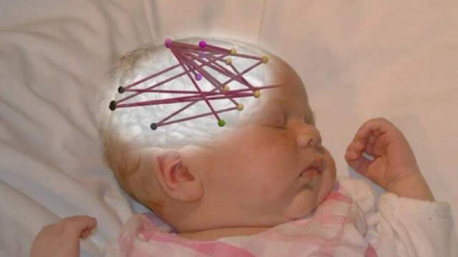 مغز کودک