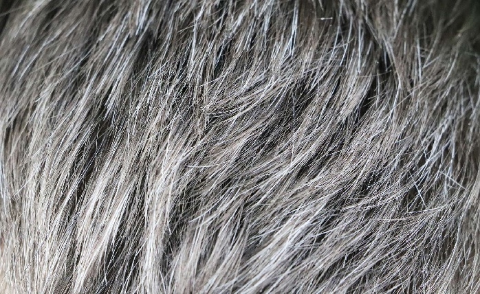 موی خاکستری