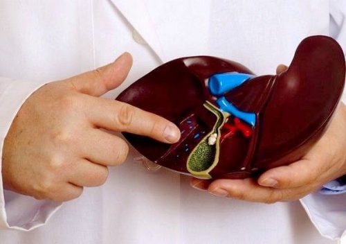 از سنگ کیسه صفرا چه میدانید علائم و راه درمان